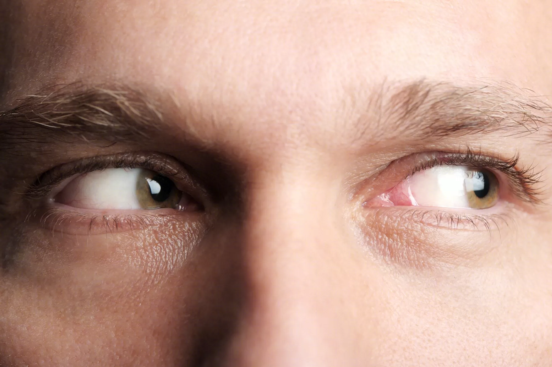 When the World's Attention Turns to Beijing: Liang Tianwei's Team Restores Clear Vision for Crossed Eyes（Strabismus） Patients