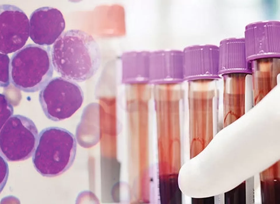 A Century of Confrontation: From Desperate Survival to Precision Annihilation in the Battle Against Blood Cancer