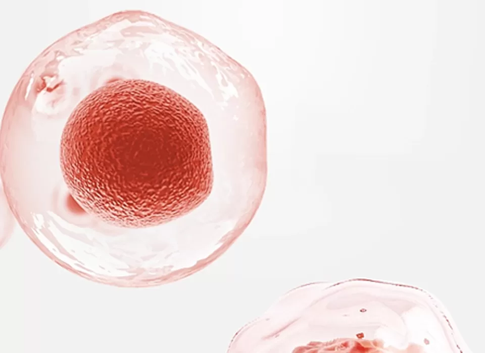 Breakthroughs in Individualized Hematopoietic Stem Cell Transplantation (HSCT) Protocols for Infants ——Clinical Innovation and Evidence-Based Practice by Dr. Liu Zhouyang