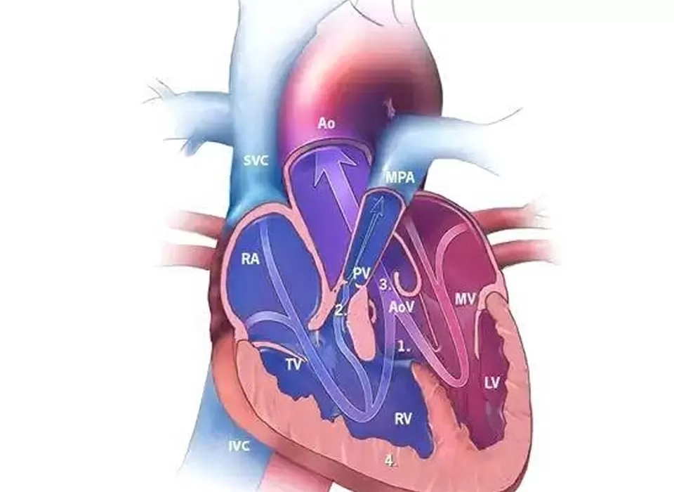 Tetralogy of Fallot: A Century-Long Journey from Despair to Hope, and the Compassionate Hearts of Healers Who Opened the Path of Life